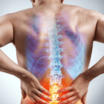 El nervio ciático y los dolores de espalda