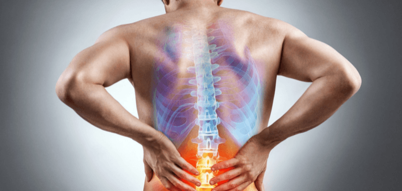 El famoso nervio ciático: ¿Responsable de todos los dolores de espalda?